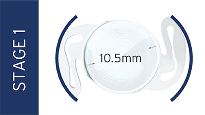 trifocal toric